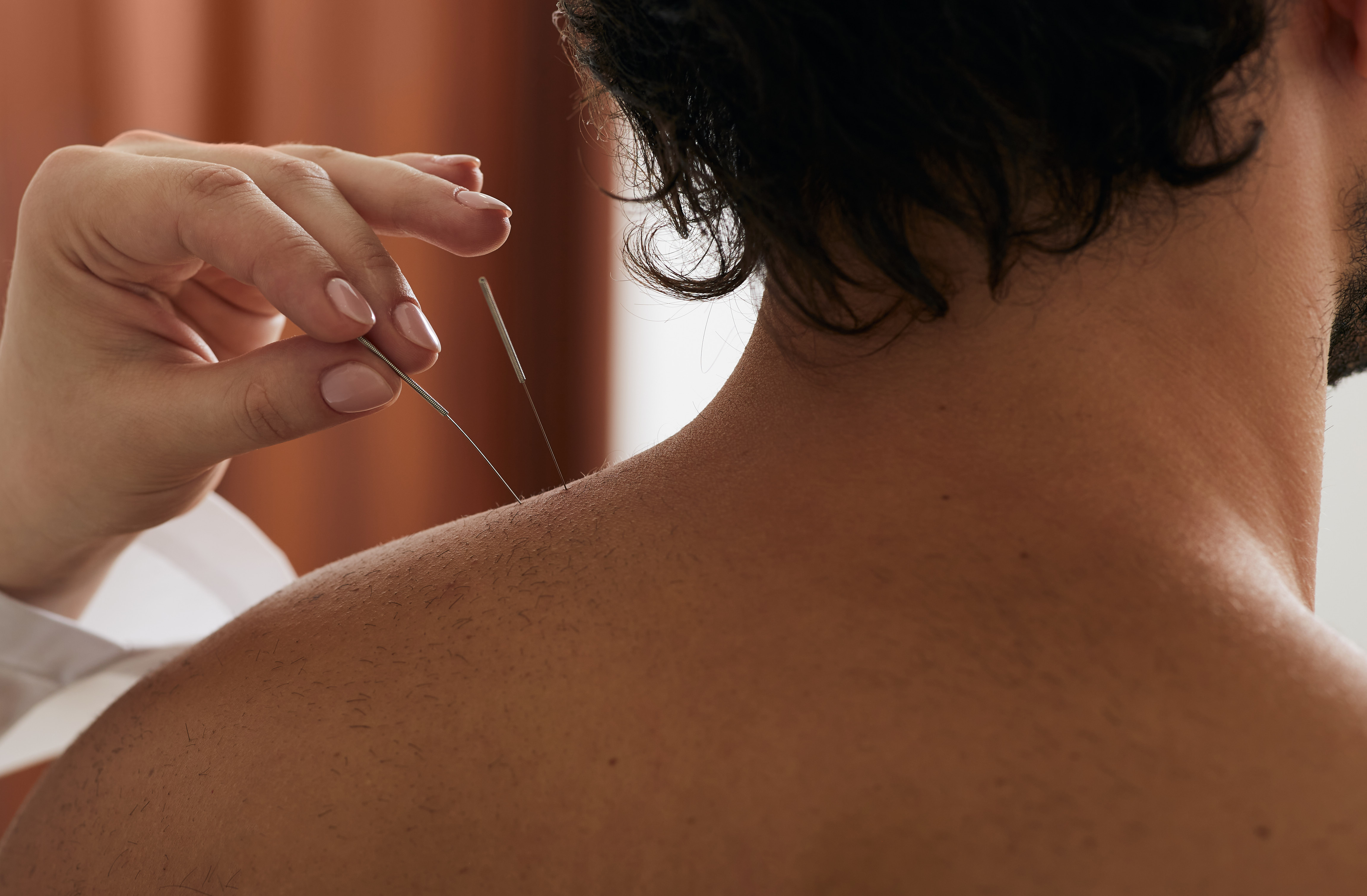 reflexologist s hand with acupuncture needle close 2026 03 25 07 43 35 utc